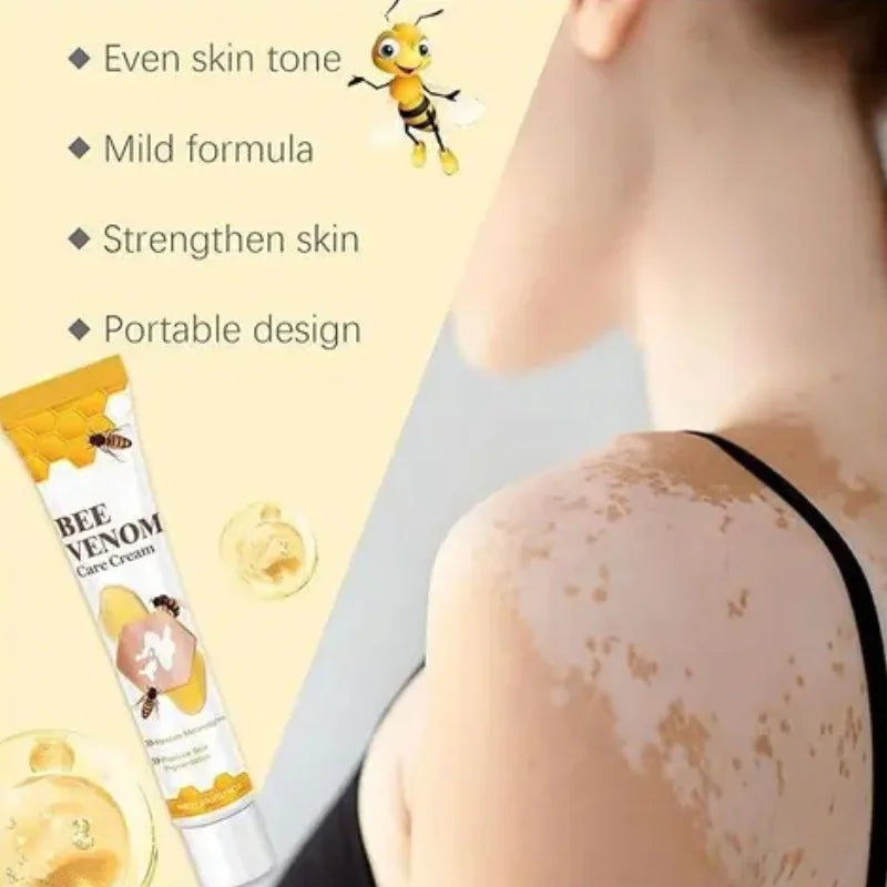 Fivfivgo Bee Venom Vitiligo Treatment Cream | Skin Repair & Hydration